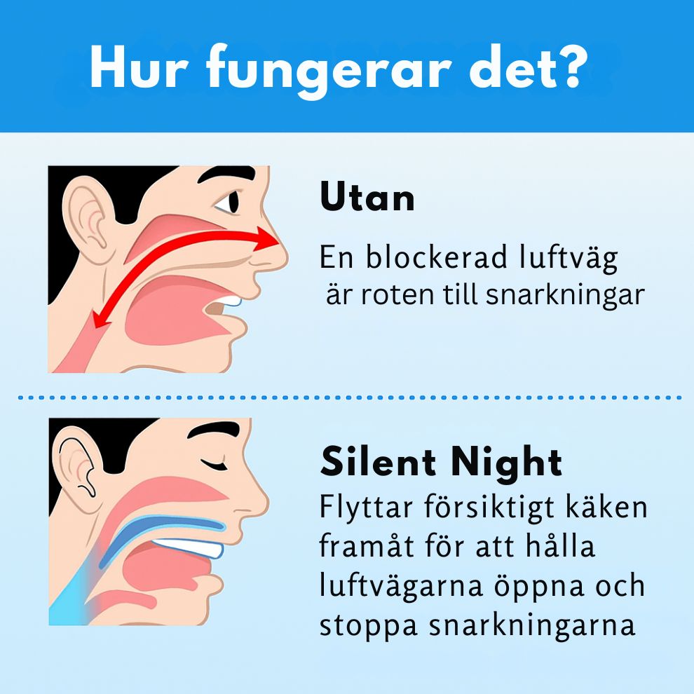 SilentNight M.A.D.S – Antisnarkskena för munnen